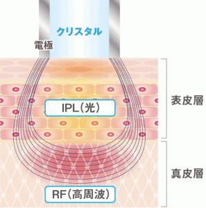 フォトRF