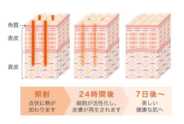 照射後の経過