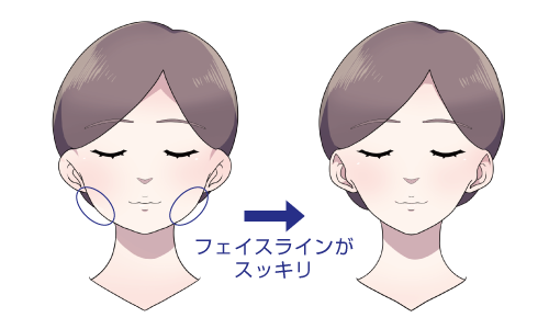 フェイスラインがスッキリ