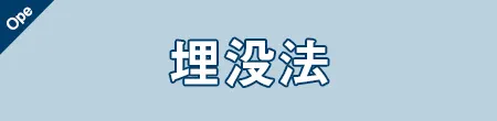 埋没法