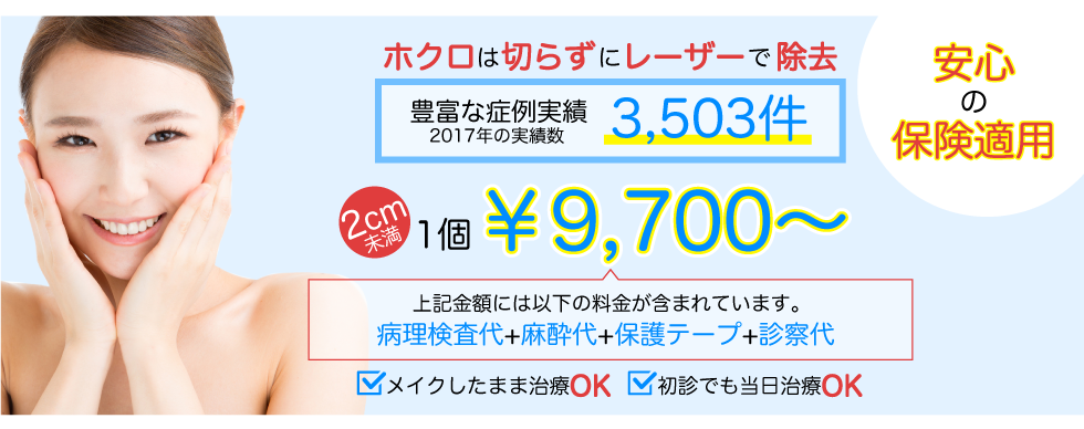 ほくろ 除去 料金