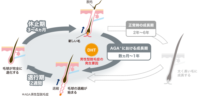 AGAのヘアサイクル