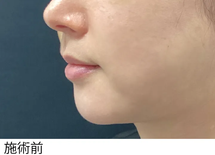 症例13施術前