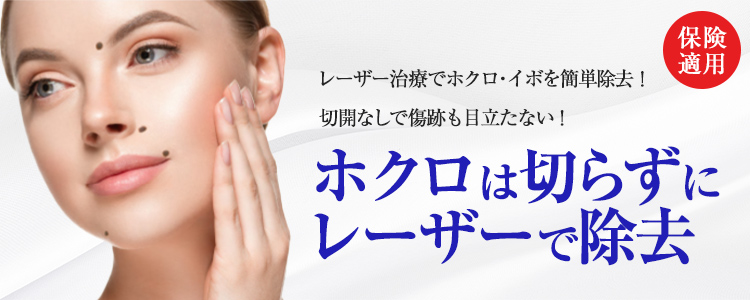ほくろ除去