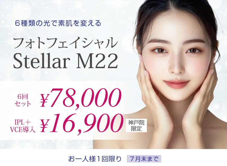 フォトフェイシャル Stellar M22