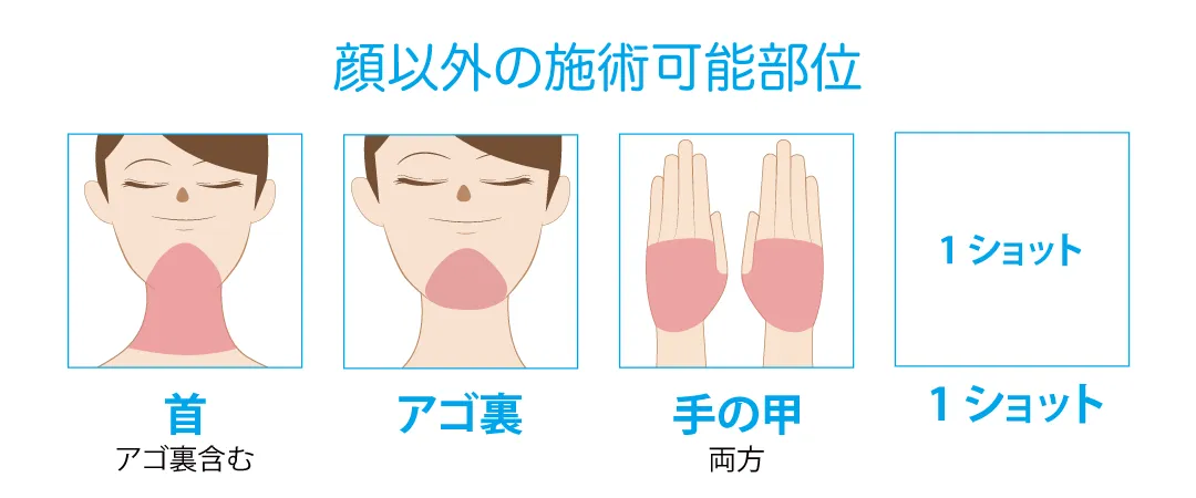 ステラM22照射可能部位