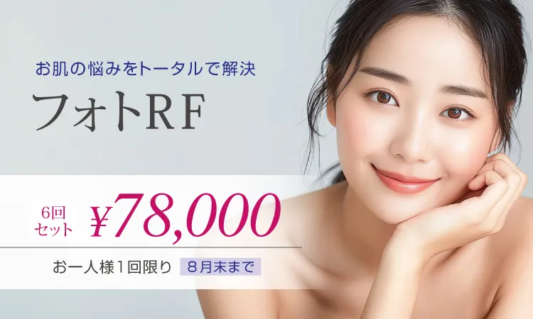 フォトRF