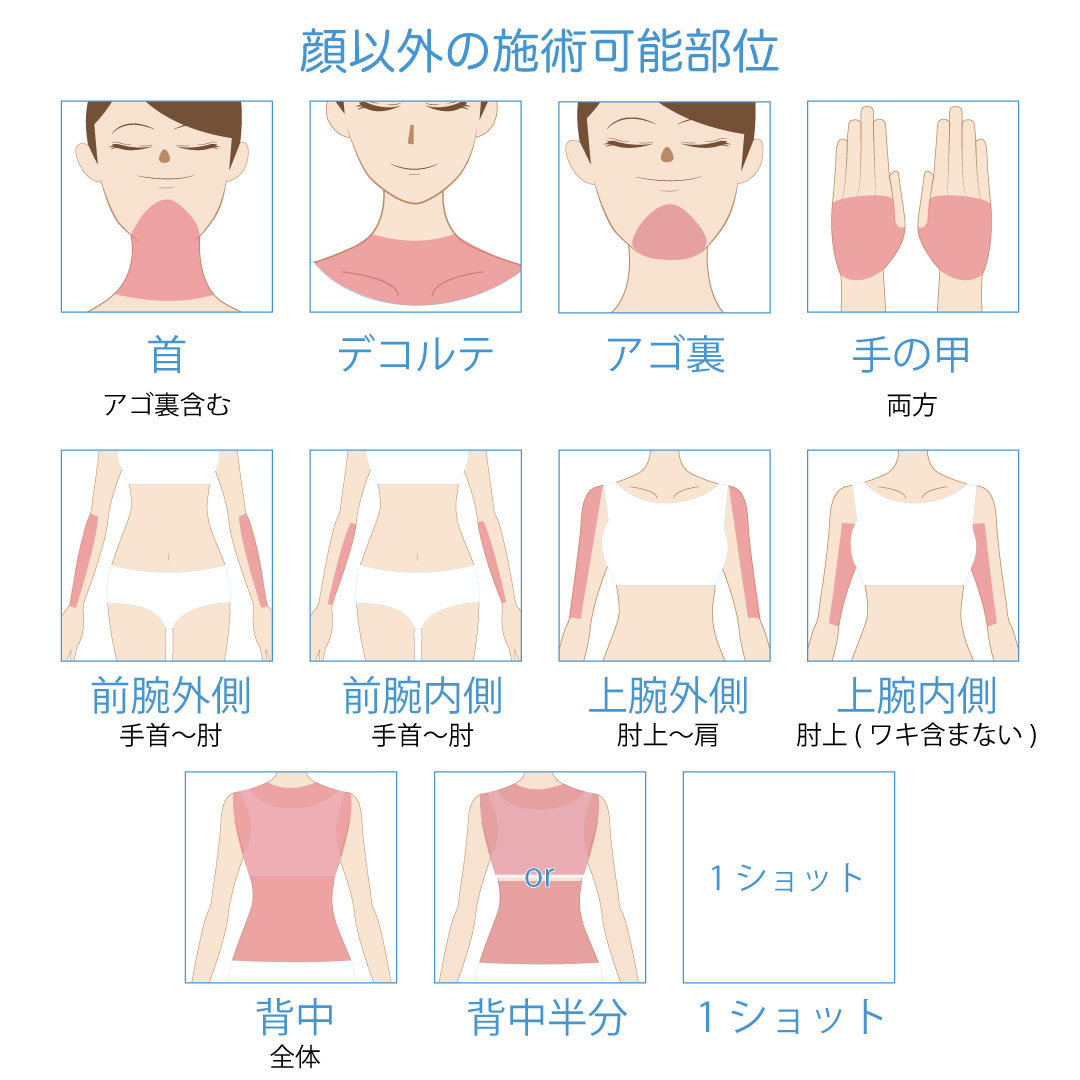 フォトRF照射可能部位