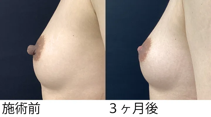 症例8施術後横