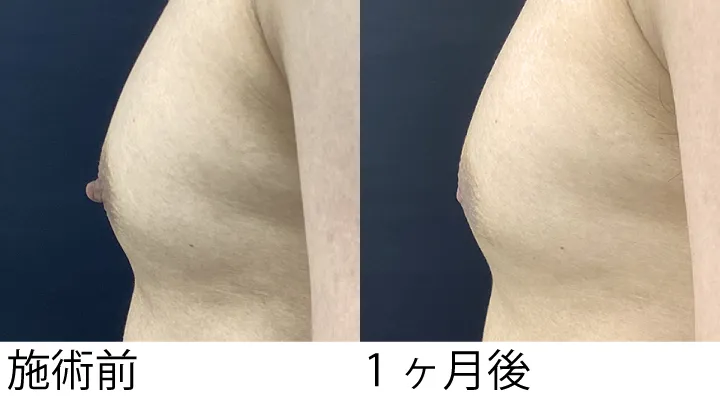 症例9施術横