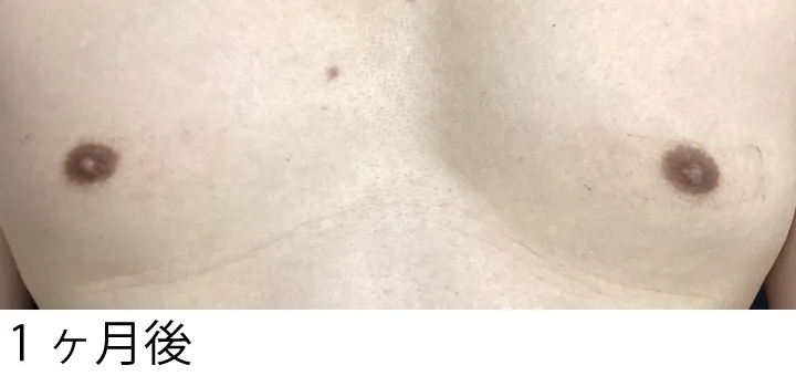 症例10施術後
