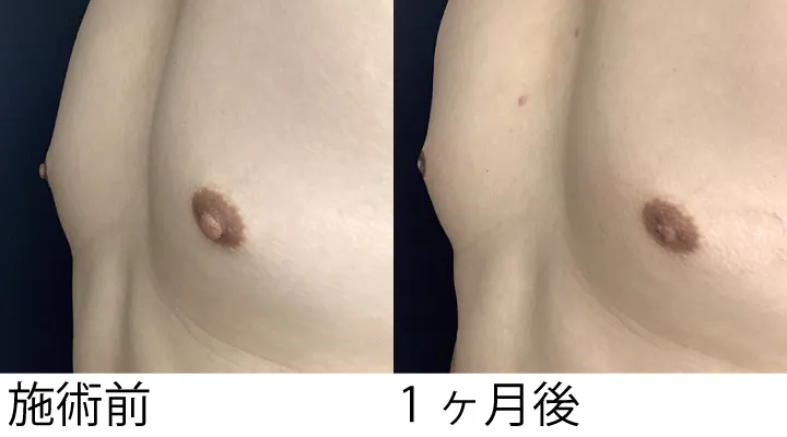 症例10施術横