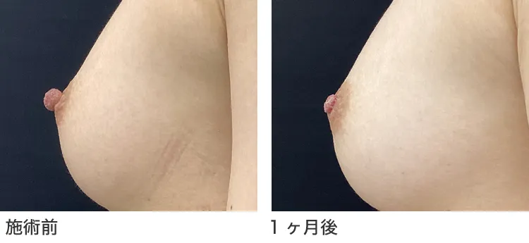 症例11施術後横