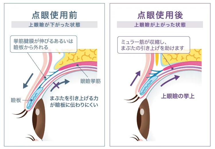 点眼使用前、使用後