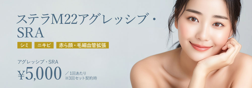 ステラM22アグレッシブ・SRA