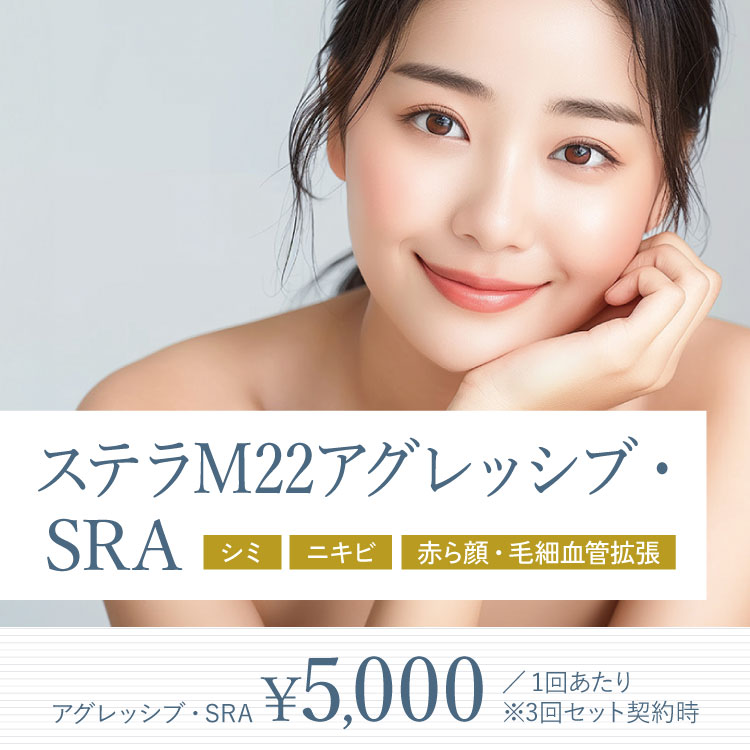 ステラM22アグレッシブ・SRA