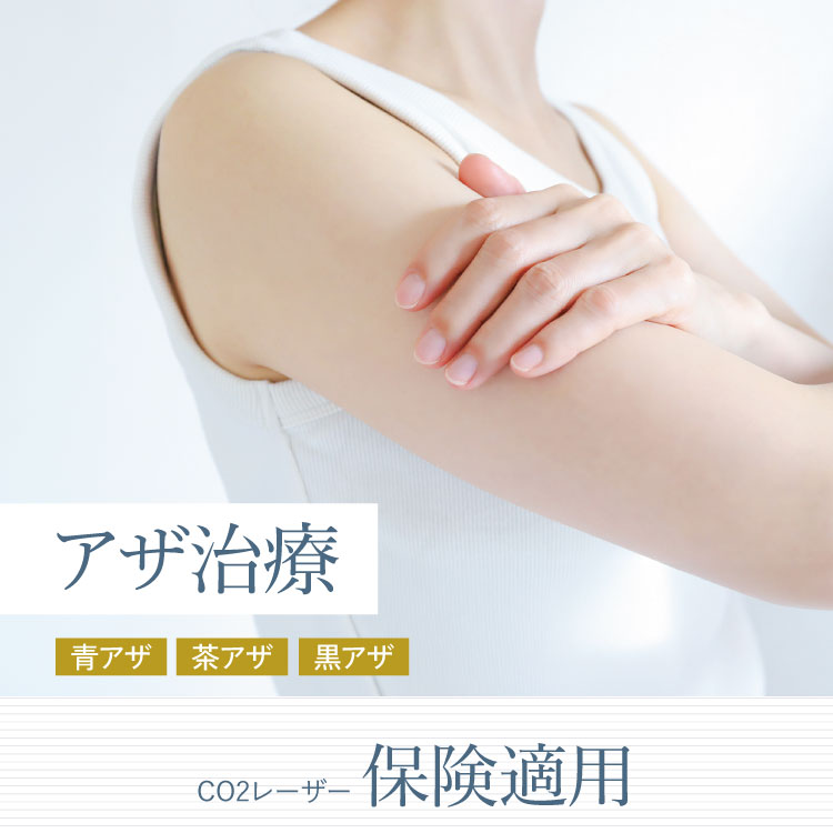 アザ治療