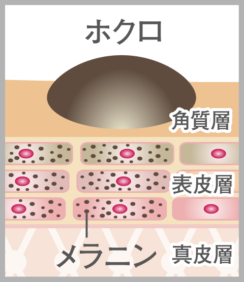 CO2レーザー治療の施術前