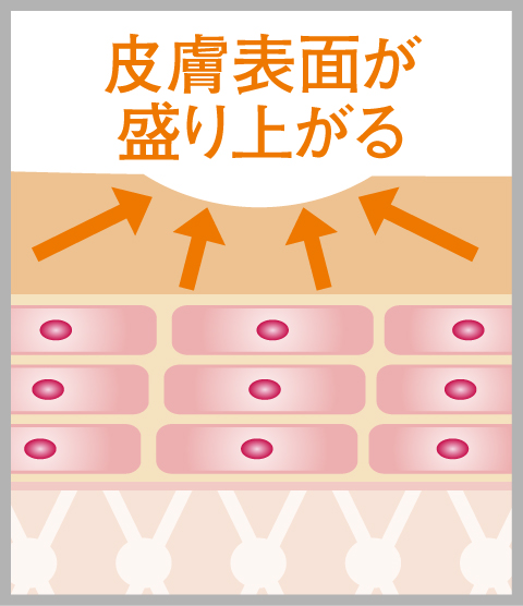 CO2レーザー治療の施術後