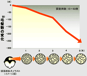 毛髪数の変化