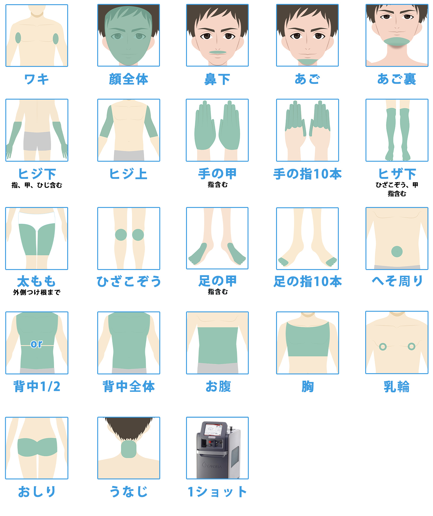 男性の脱毛照射可能部位
