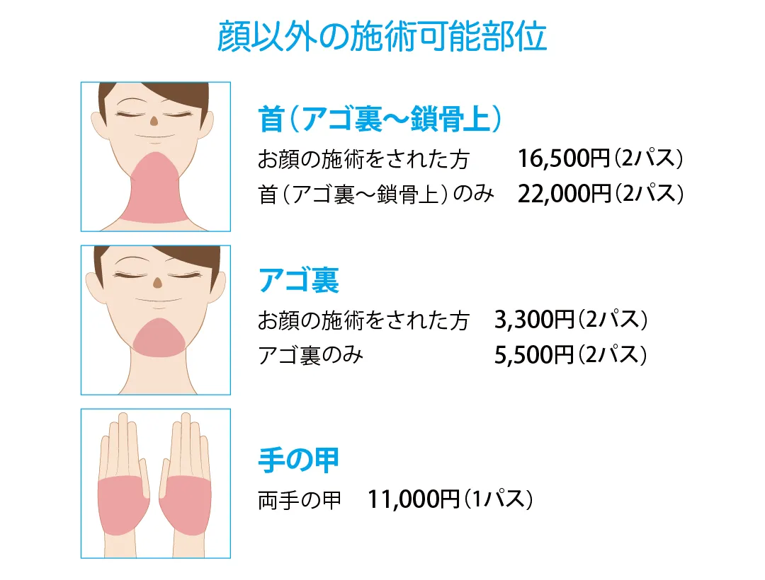 フォトRF 顔以外の施術可能部位