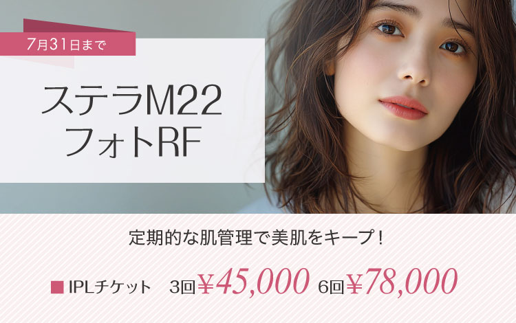 IPLチケット