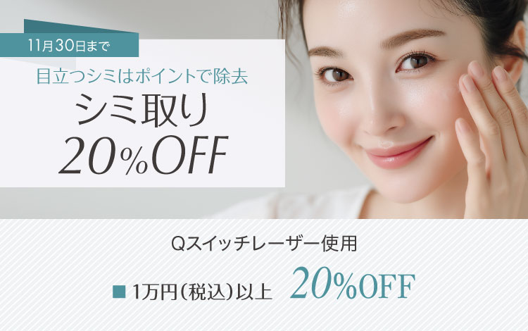 シミ取り20％OFF Qスイッチレーザー使用 1万円（税込）以上20％OFF