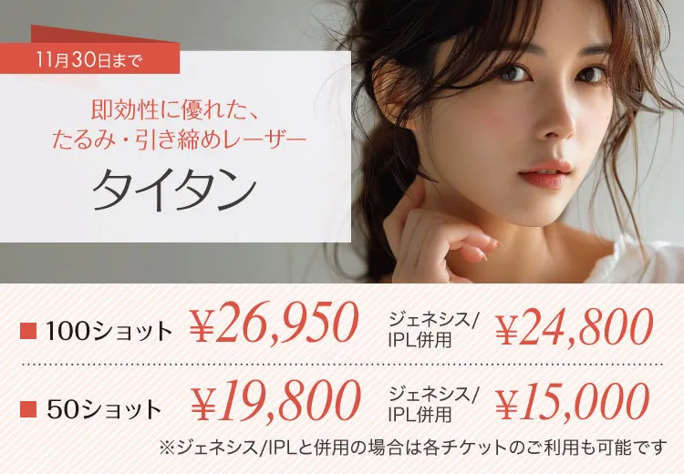 タイタン 100ショット26,950円 50ショット19,800円