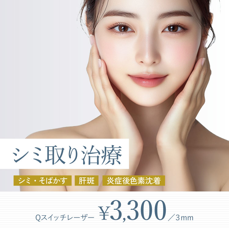 シミ取り治療