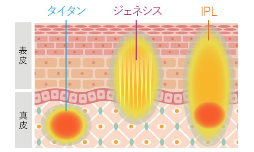 スペシャルコースの作用イメージ