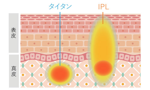 ハリ・くすみ改善コースの作用イメージ